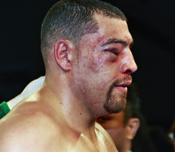 © Jim Everett/SaddoBoxing de la foto