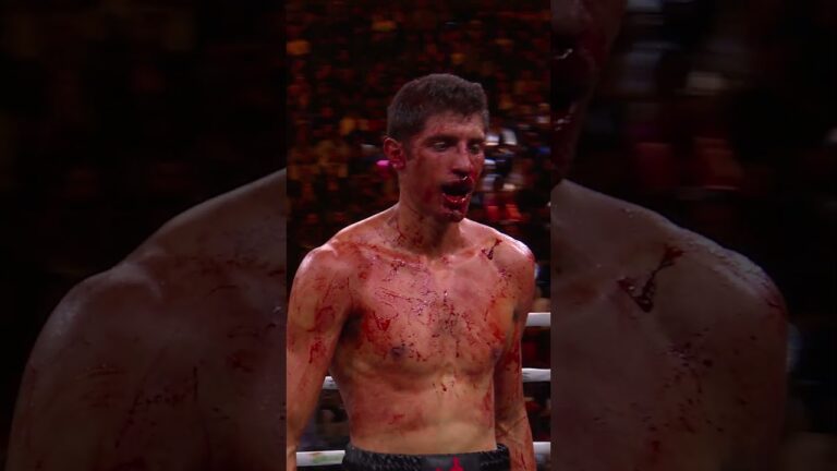 Sebastian Fundora Endures a Bloody Battle to Become a Unified 154-lb Champ