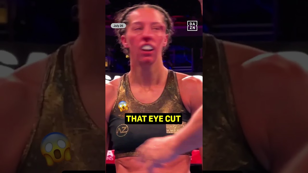 Licia Boudersa suffers a bad eye cut against Caroline Veyre 😬 #shorts