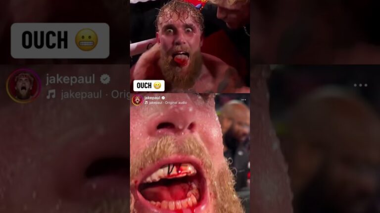 Jakeâ€™s left teeth are pushed back in his mouth from AJâ€™s right hand 👊 #JakeJoshua