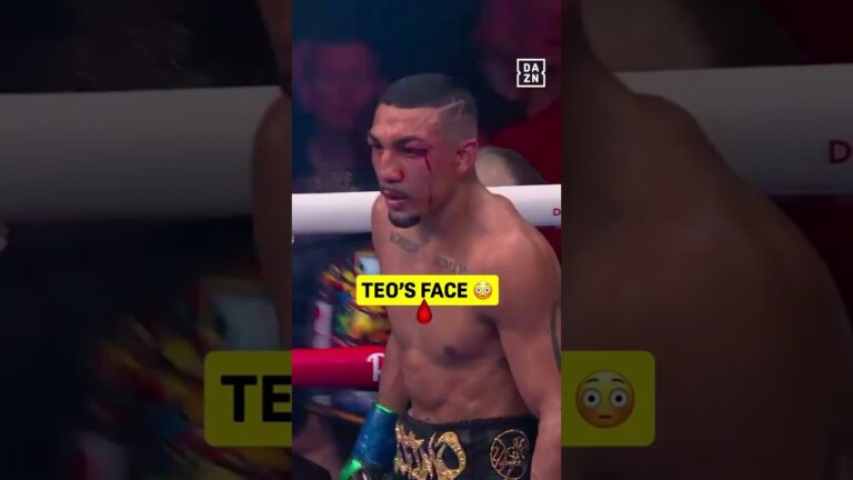 Shakur had Teofimo drawing blood in the championship rounds 👀🥊#RING6 | Ring Magazine ▪️