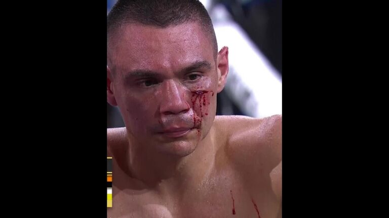 Clash of heads lead to cut on Tszyu