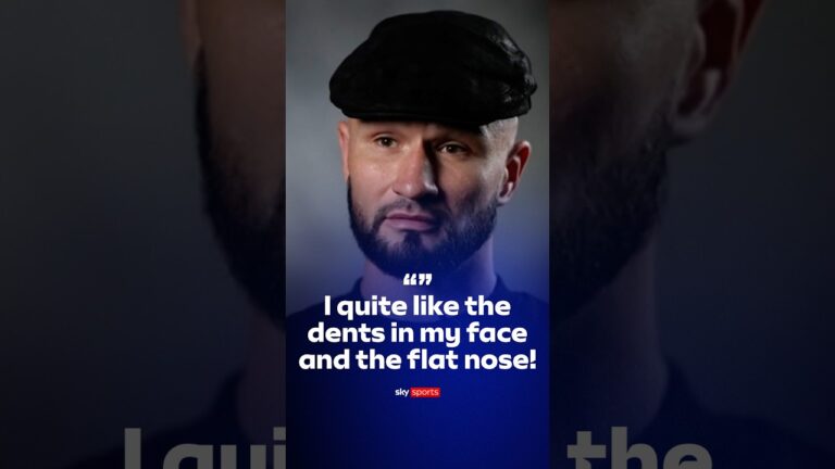 “I quite like the dents in my face and flat nose!” 🔥